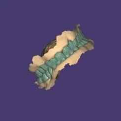 i desgined this case with exocad app