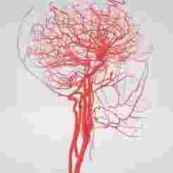 3D Head & Neck, Intracranial Arterial System Anatomy