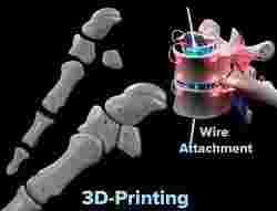 Wire attachment - 3D-Printing Skeletal System - PREVIEW
