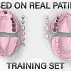 Prosthodontic Training Model – Maxilla & Mandible with Segmented Teeth/Abutments